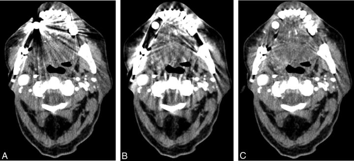 Fig 1.