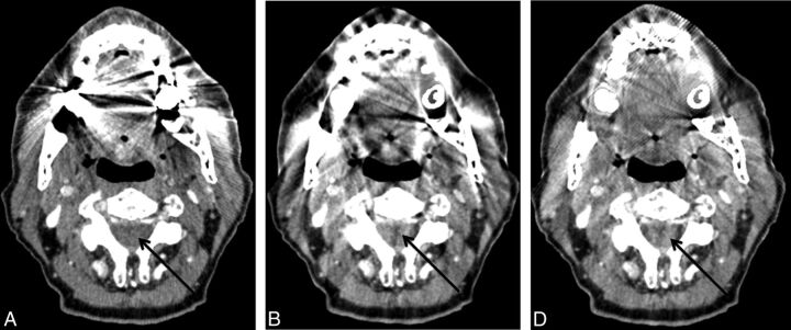 Fig 5.