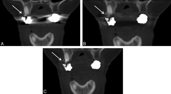 Fig 4.