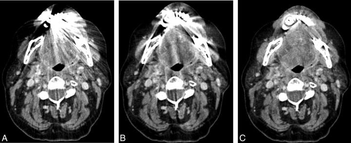 Fig 2.