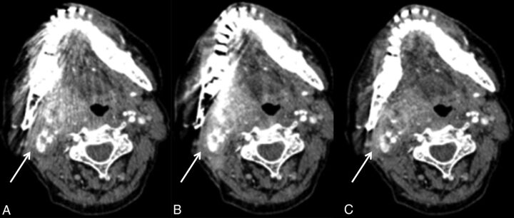 Fig 3.