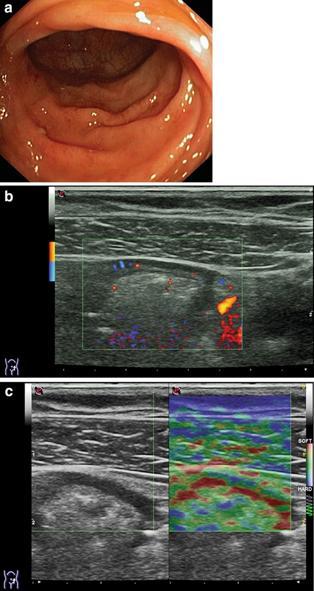 Fig. 6