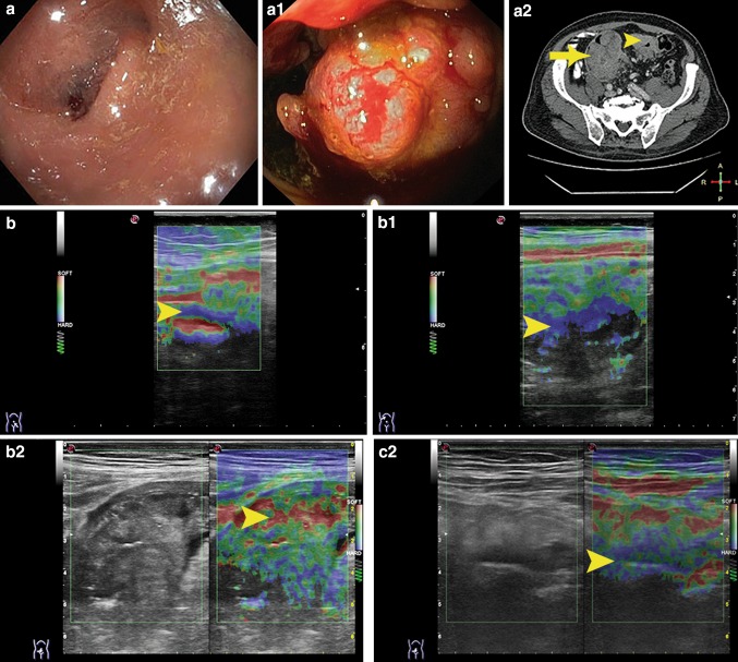 Fig. 2