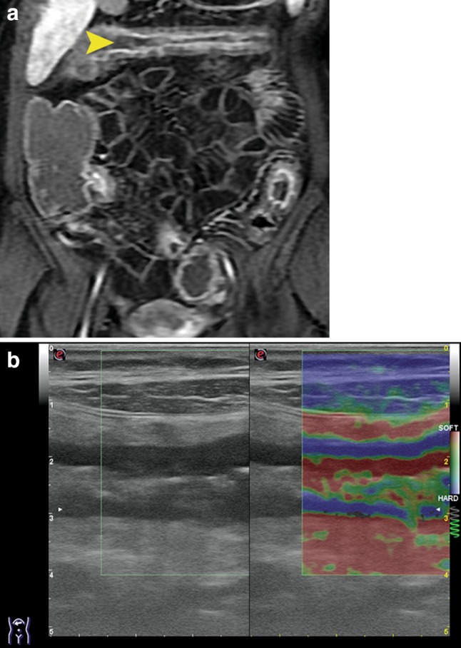 Fig. 10