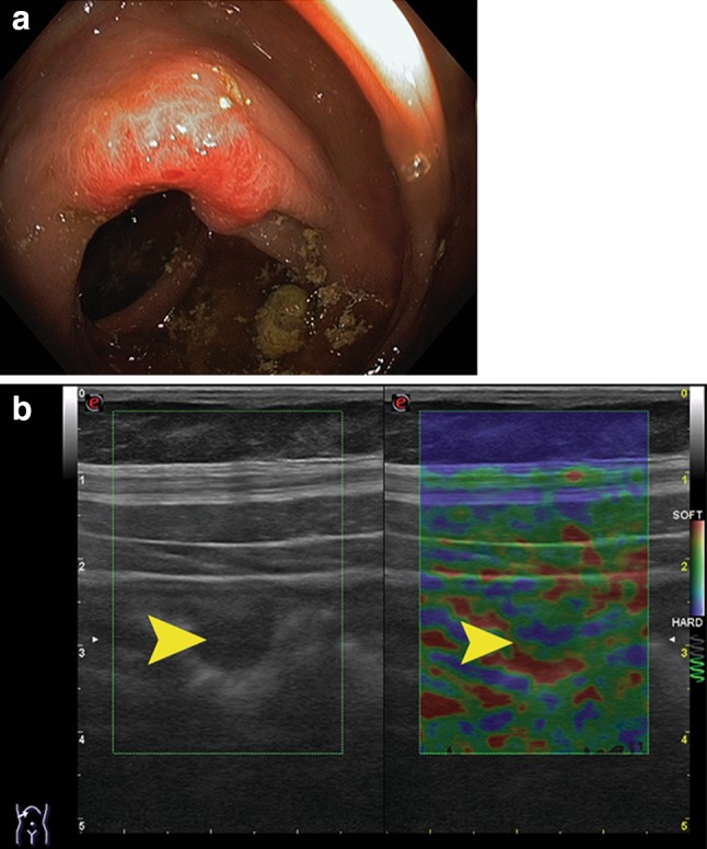 Fig. 3