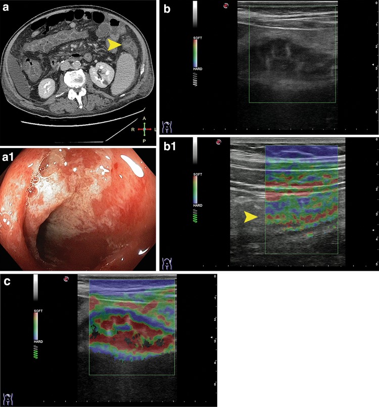 Fig. 11