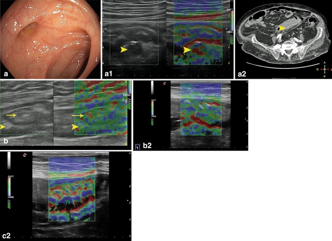 Fig. 12