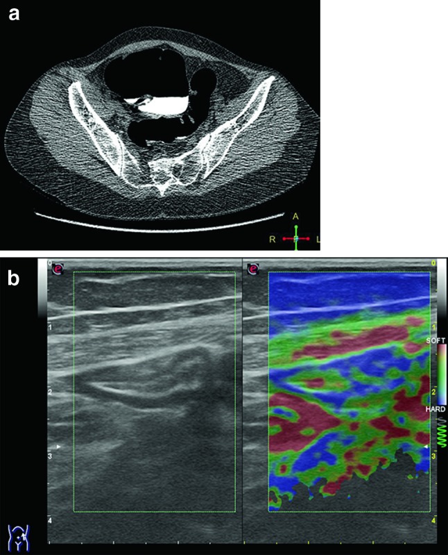 Fig. 13