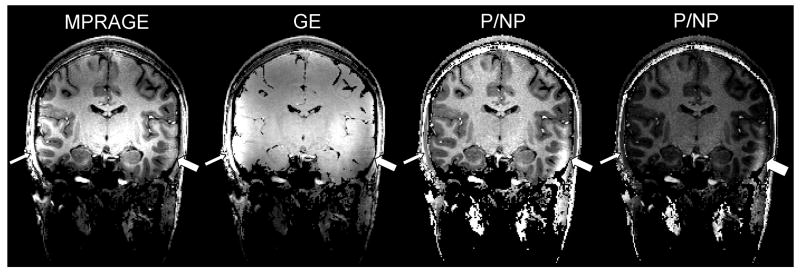 Fig. 12