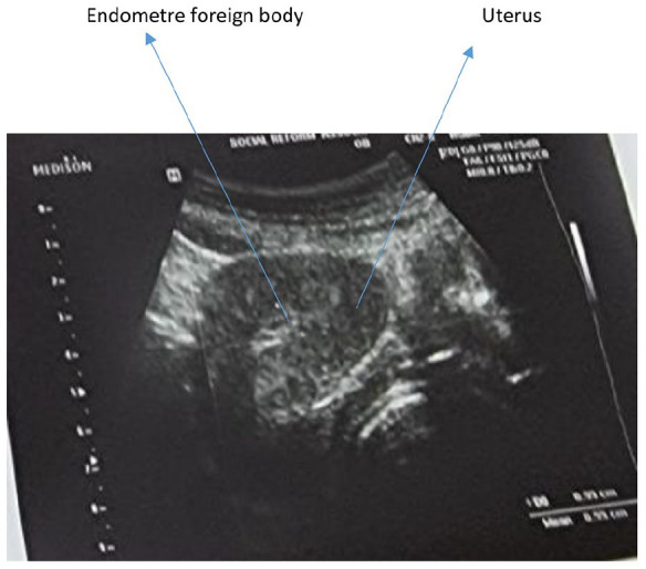 Figure1.