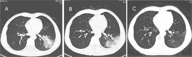 Fig. 2