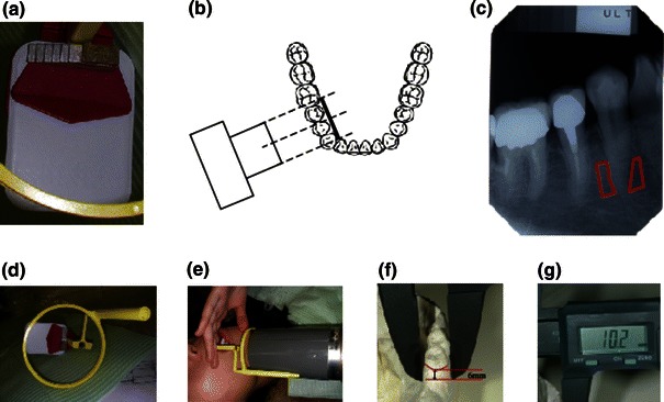 Fig. 1