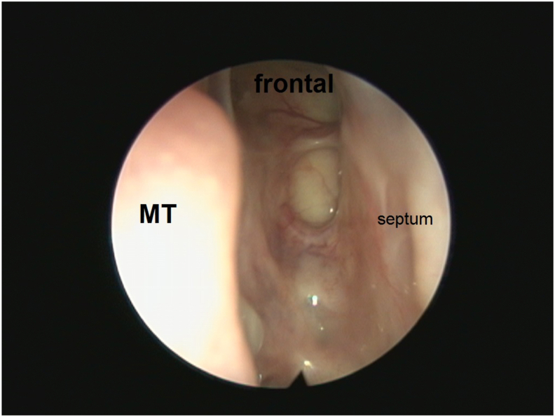 Fig. 4