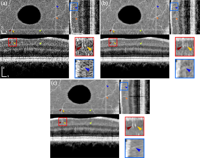 Fig. 4