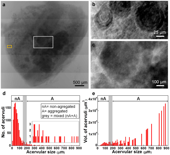 Growth patterns for acervuli in human pineal gland - PMC