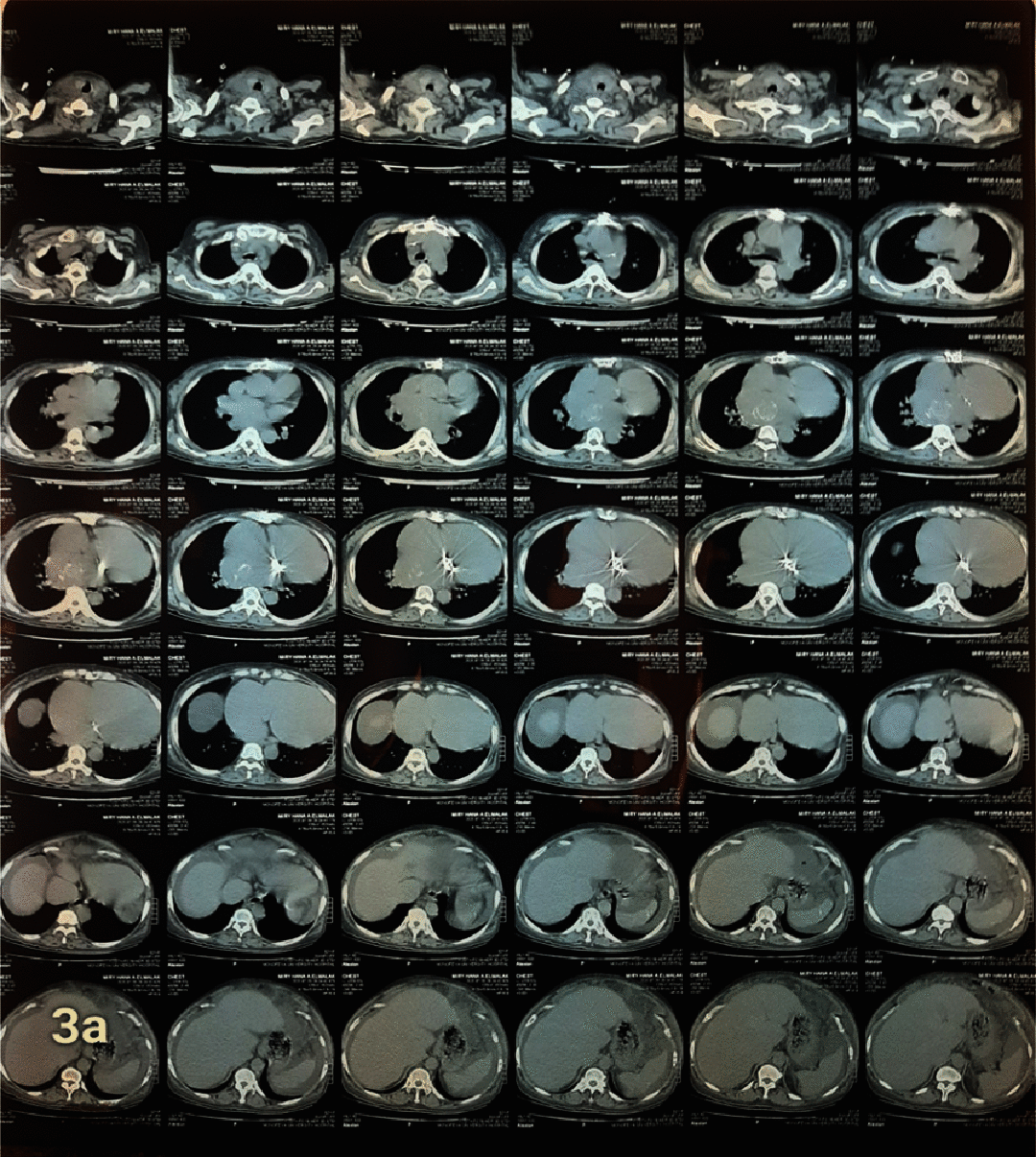 Figure 3a.