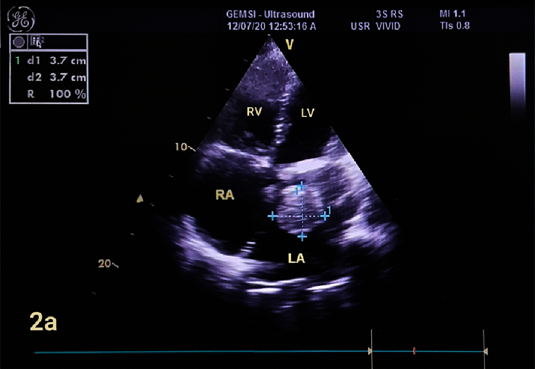 Figure 2a.