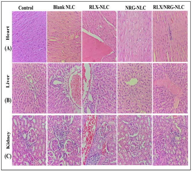 Figure 11