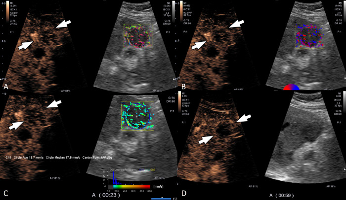 Fig 4