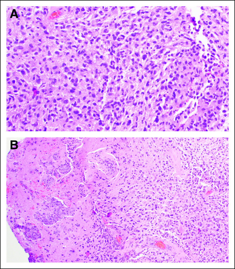 FIG 2.