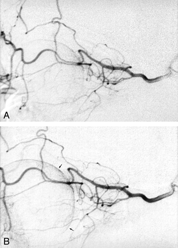 Fig 1.