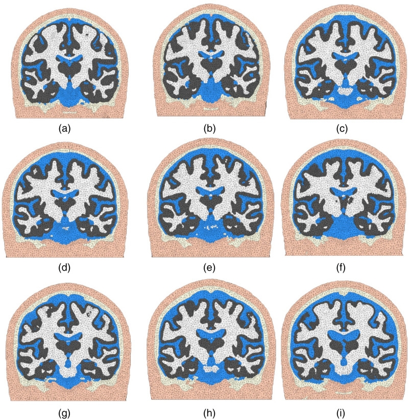 Fig. 9