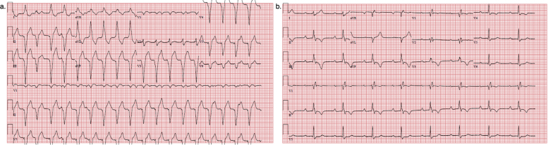 Supplementary Figure 1