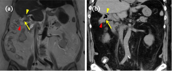 FIGURE 3