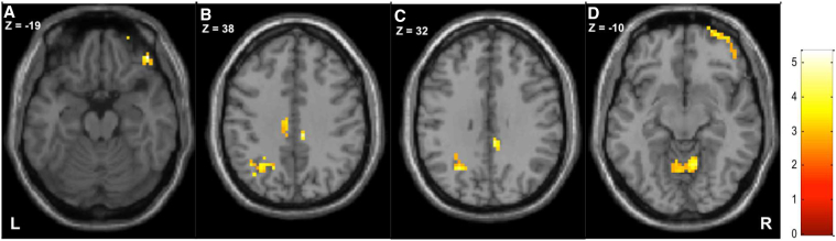 Fig. 2