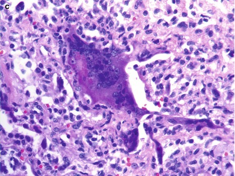 Fig. 8.3