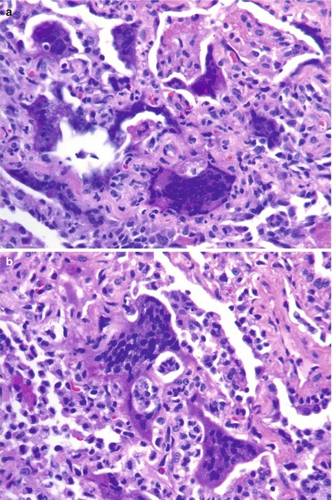 Fig. 8.3