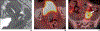 Fig. 11—