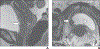 Fig. 7—