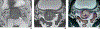 Fig. 6—