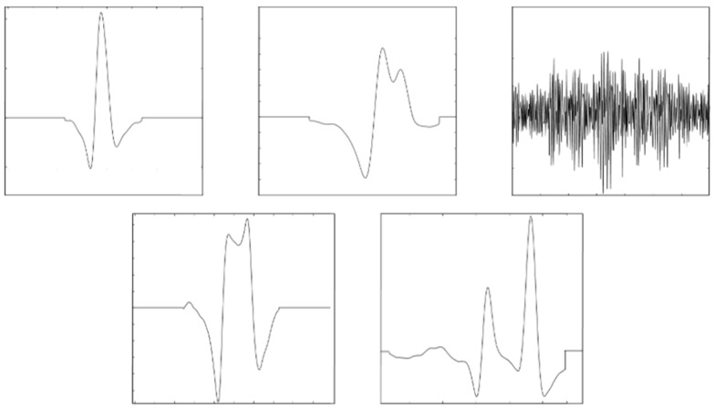 Figure 15