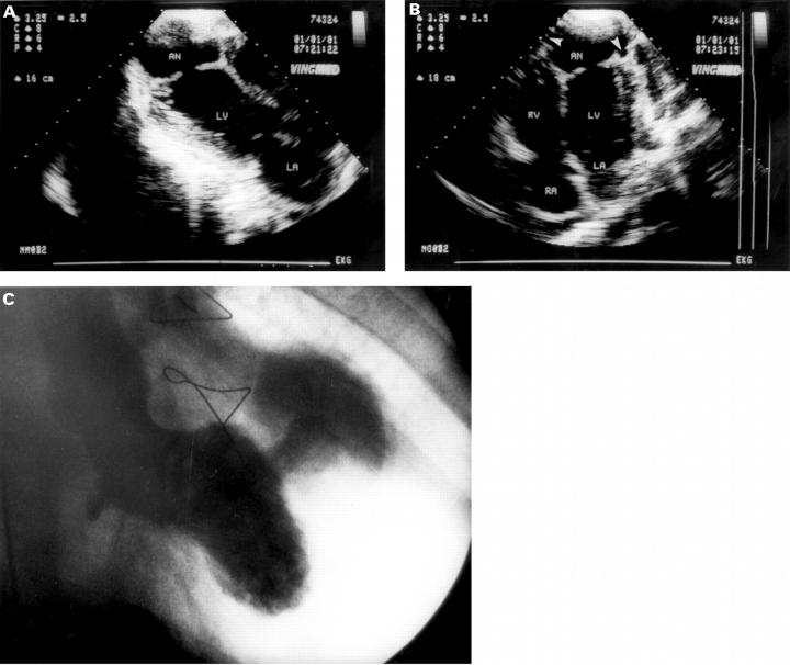 Figure 2  