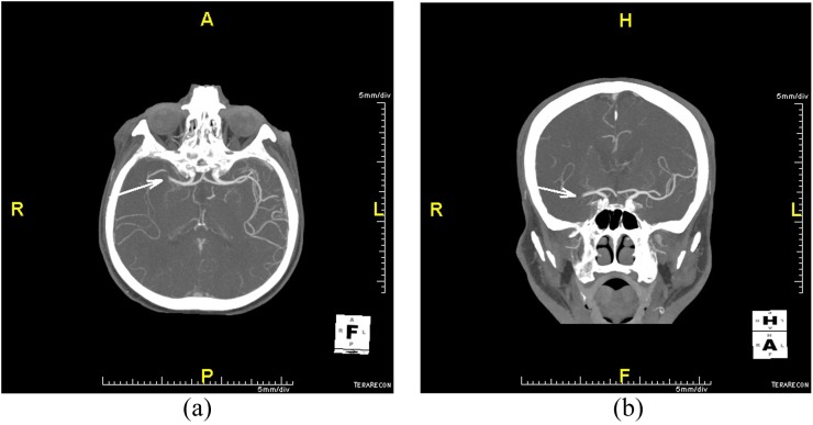 Figure 3.