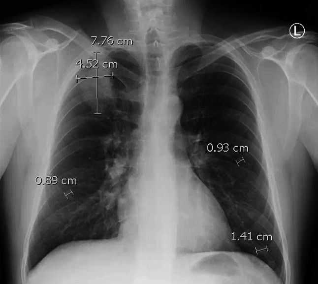 Fig. 3