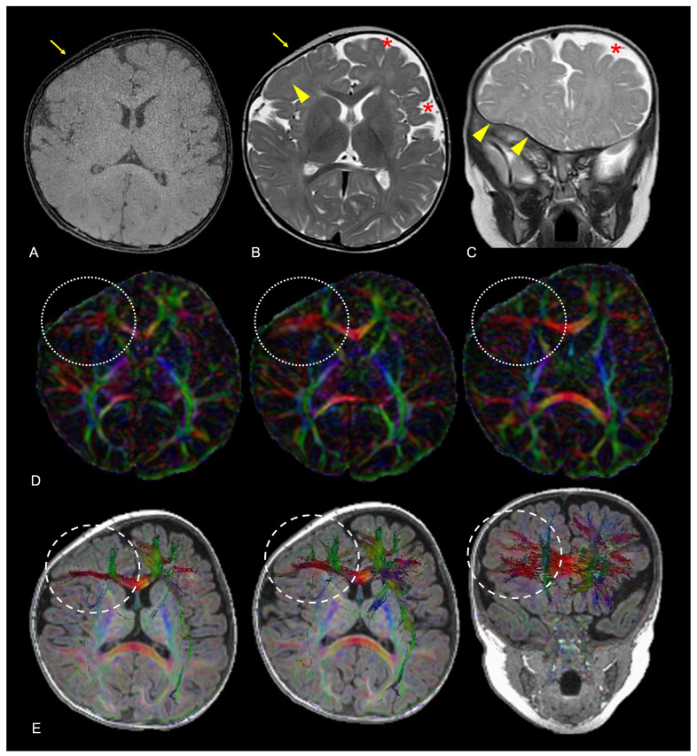 Figure 15