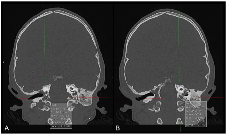 Figure 10