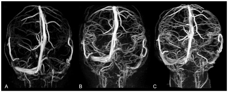 Figure 13