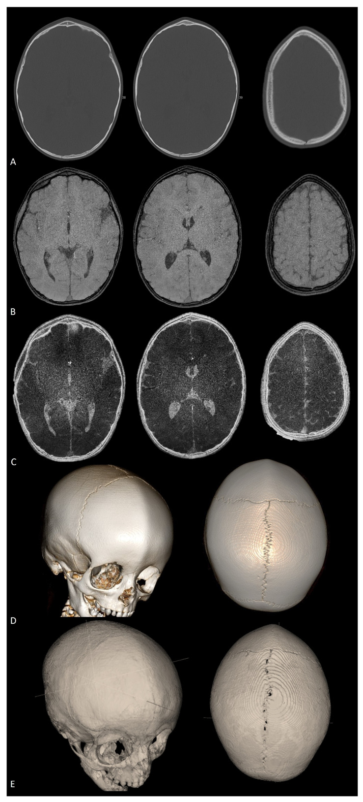 Figure 12