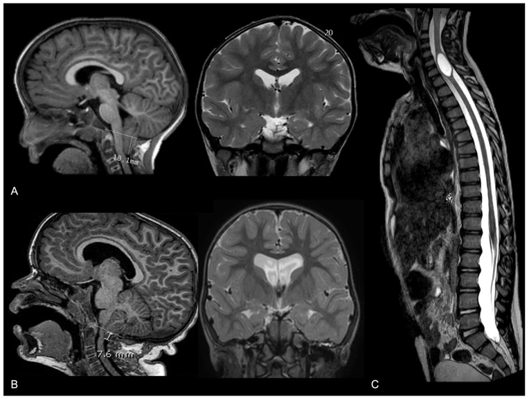 Figure 16