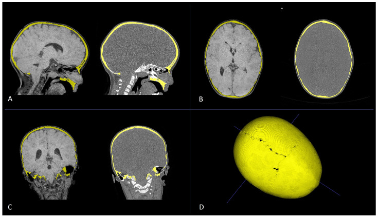 Figure 11