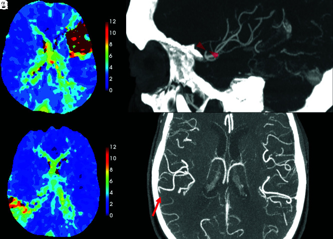 FIG 3.