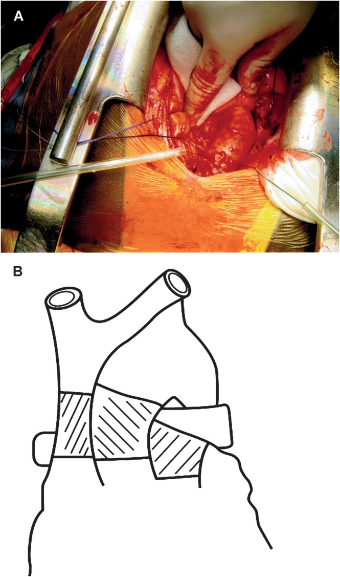 Figure 2: