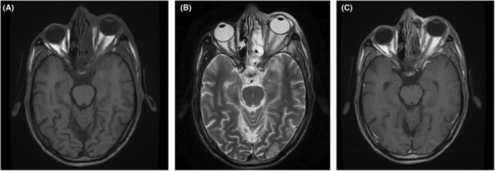 FIGURE 1