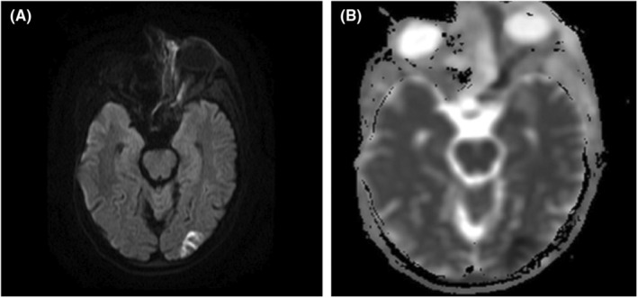 FIGURE 2