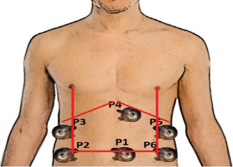 FIGURE 1