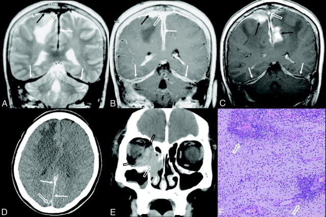 Fig 2.